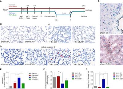 Acute Intoxication With Alcohol Reduces Trauma-Induced Proinflammatory Response and Barrier Breakdown in the Lung via the Wnt/β-Catenin Signaling Pathway